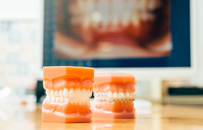 歯の機能を正しく整えるための矯正治療